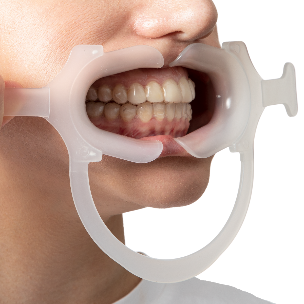 Hands Free Retractor in the mouth